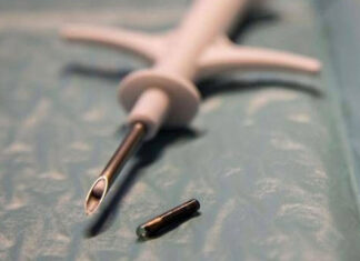 Subcutaneous Chips are replacing Cards and Keys